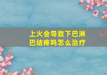 上火会导致下巴淋巴结疼吗怎么治疗