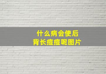 什么病会使后背长痘痘呢图片