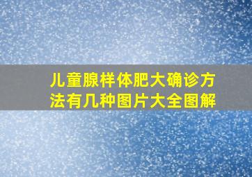 儿童腺样体肥大确诊方法有几种图片大全图解