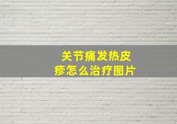 关节痛发热皮疹怎么治疗图片