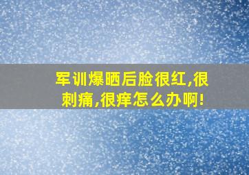 军训爆晒后脸很红,很刺痛,很痒怎么办啊!