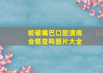 咬破嘴巴口腔溃疡会癌变吗图片大全