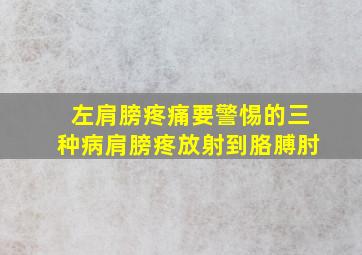 左肩膀疼痛要警惕的三种病肩膀疼放射到胳膊肘