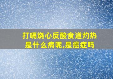 打嗝烧心反酸食道灼热是什么病呢,是癌症吗