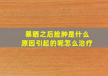 暴晒之后脸肿是什么原因引起的呢怎么治疗