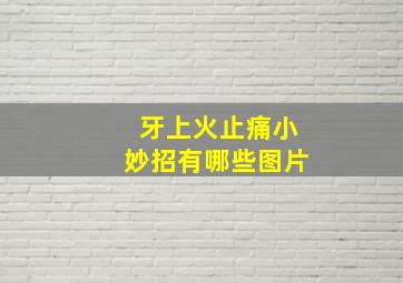 牙上火止痛小妙招有哪些图片