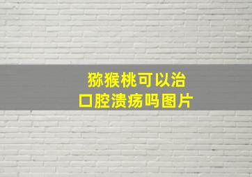 猕猴桃可以治口腔溃疡吗图片