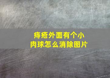 痔疮外面有个小肉球怎么消除图片