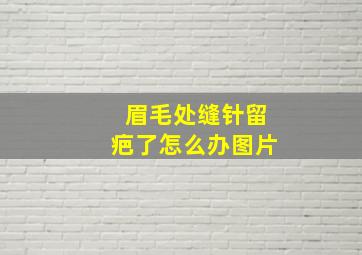 眉毛处缝针留疤了怎么办图片