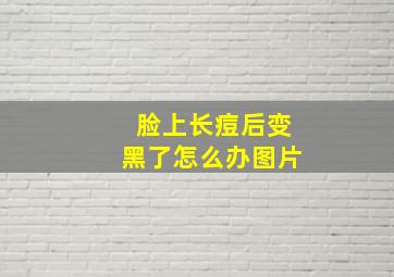 脸上长痘后变黑了怎么办图片