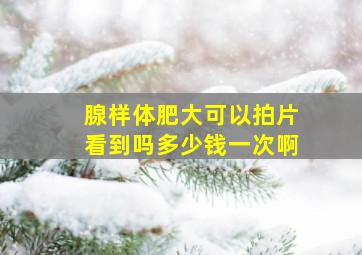 腺样体肥大可以拍片看到吗多少钱一次啊