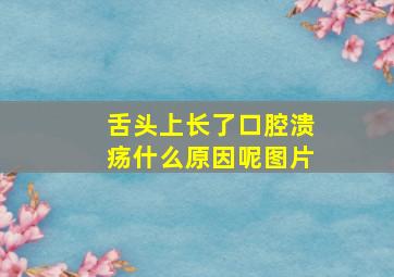 舌头上长了口腔溃疡什么原因呢图片