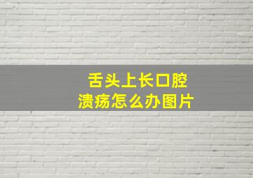 舌头上长口腔溃疡怎么办图片