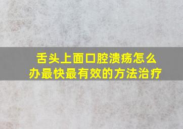 舌头上面口腔溃疡怎么办最快最有效的方法治疗