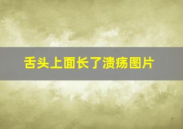 舌头上面长了溃疡图片