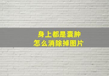 身上都是囊肿怎么消除掉图片