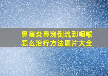 鼻窦炎鼻涕倒流到咽喉怎么治疗方法图片大全